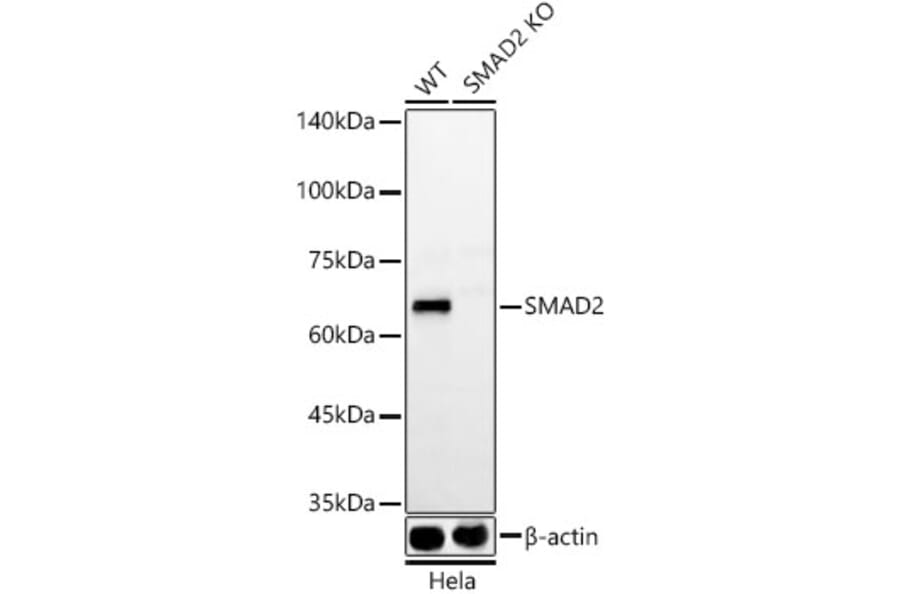 Western Blot - Anti-Smad2 Antibody [ARC57635] (A309474) - Antibodies.com