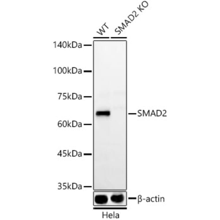 Western Blot - Anti-Smad2 Antibody [ARC57635] (A309474) - Antibodies.com