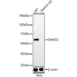 Western Blot - Anti-Smad2 Antibody [ARC57635] (A309474) - Antibodies.com