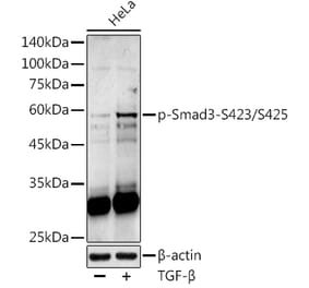Western Blot - Anti-Smad3 (phospho Ser423 + Ser425) Antibody (A309475) - Antibodies.com