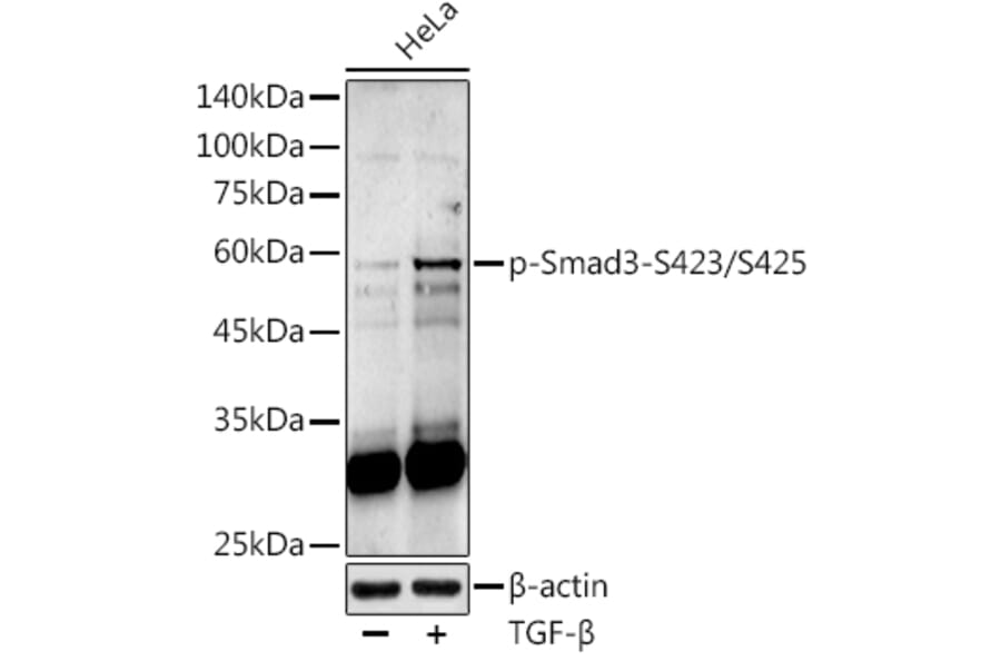 Western Blot - Anti-Smad3 (phospho Ser423 + Ser425) Antibody (A309475) - Antibodies.com