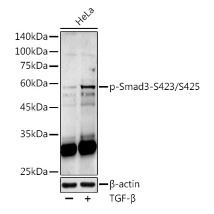 Western Blot - Anti-Smad3 (phospho Ser423 + Ser425) Antibody (A309475) - Antibodies.com