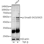 Western Blot - Anti-Smad3 (phospho Ser423 + Ser425) Antibody (A309475) - Antibodies.com