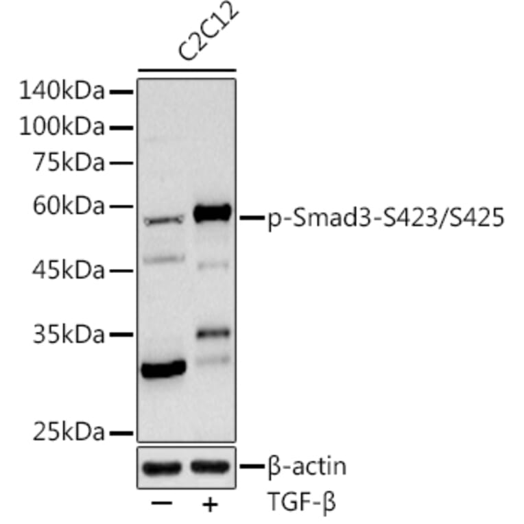 Western Blot - Anti-Smad3 (phospho Ser423 + Ser425) Antibody (A309475) - Antibodies.com