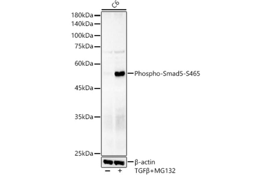 Western Blot - Anti-SMAD5 (phospho Ser465) Antibody [ARC59204] (A309476) - Antibodies.com
