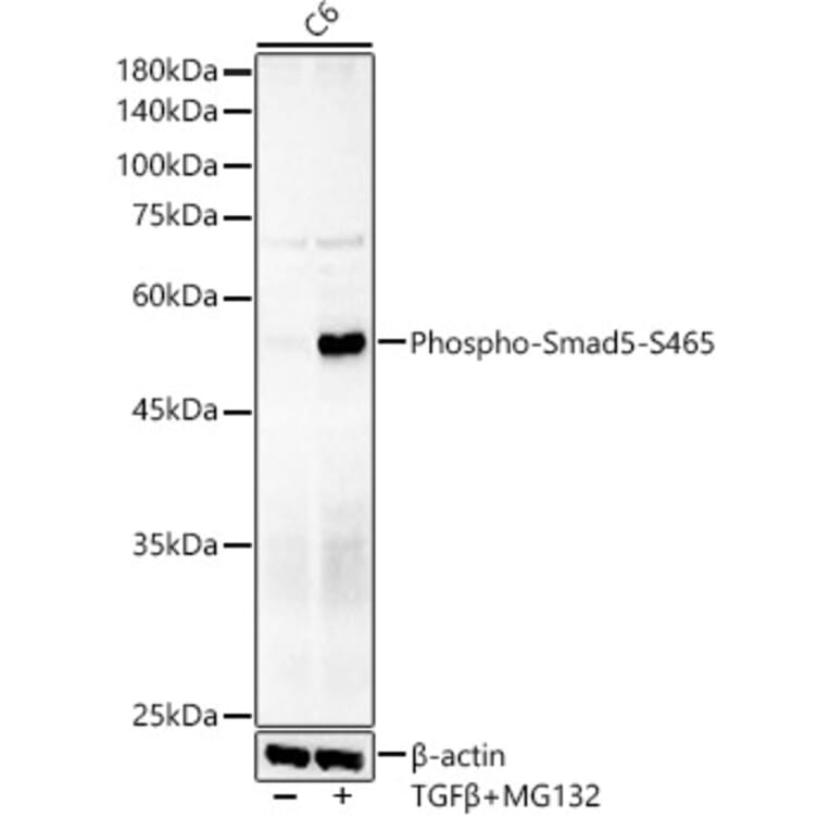 Western Blot - Anti-SMAD5 (phospho Ser465) Antibody [ARC59204] (A309476) - Antibodies.com