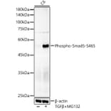 Western Blot - Anti-SMAD5 (phospho Ser465) Antibody [ARC59204] (A309476) - Antibodies.com