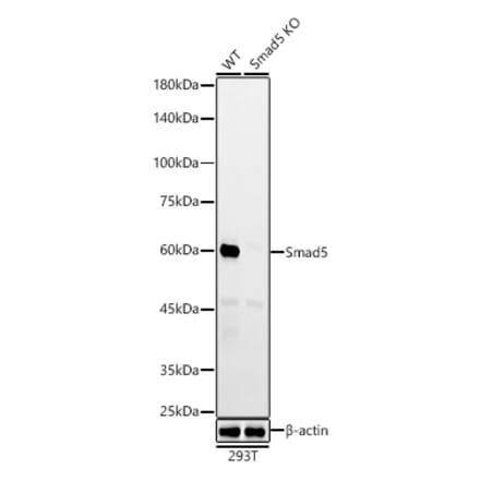 Western Blot - Anti-SMAD5 Antibody [ARC55344] (A309477) - Antibodies.com
