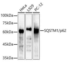 Western Blot - Anti-SQSTM1 / p62 Antibody (A309479) - Antibodies.com