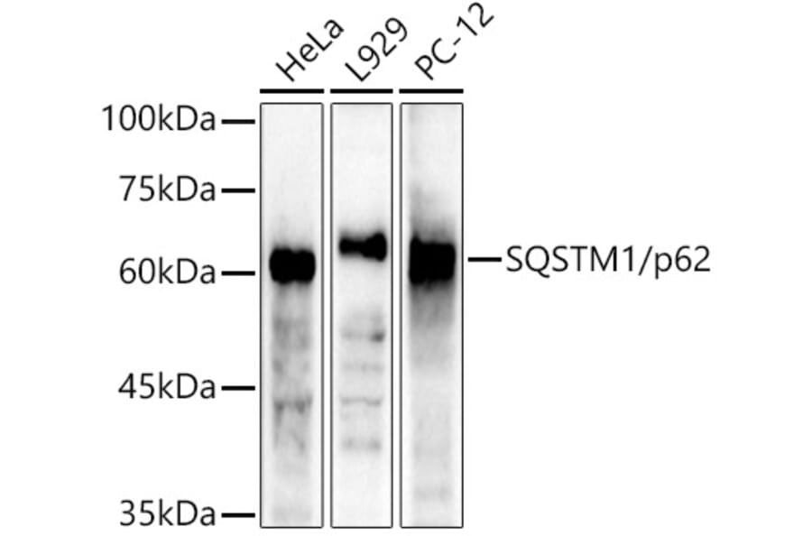 Western Blot - Anti-SQSTM1 / p62 Antibody (A309479) - Antibodies.com