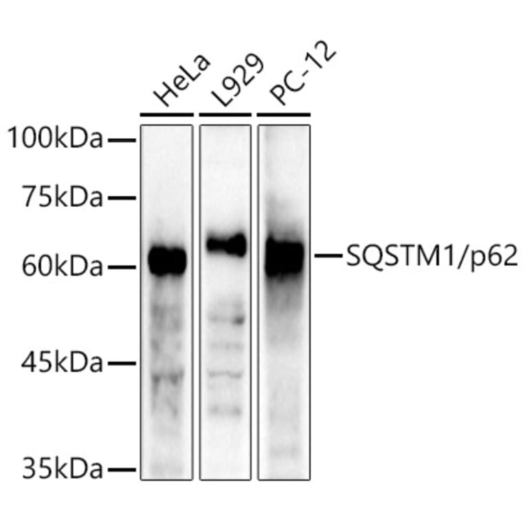 Western Blot - Anti-SQSTM1 / p62 Antibody (A309479) - Antibodies.com