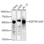 Western Blot - Anti-SQSTM1 / p62 Antibody (A309479) - Antibodies.com