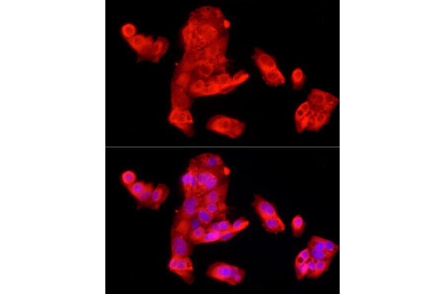 Immunofluorescence - Anti-SQSTM1 / p62 Antibody (A309479) - Antibodies.com