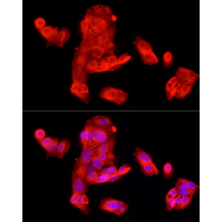 Immunofluorescence - Anti-SQSTM1 / p62 Antibody (A309479) - Antibodies.com