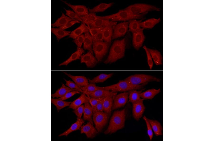 Immunofluorescence - Anti-SQSTM1 / p62 Antibody (A309479) - Antibodies.com