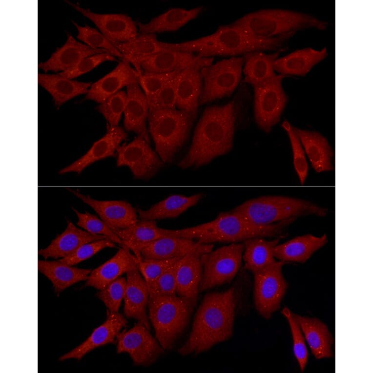 Immunofluorescence - Anti-SQSTM1 / p62 Antibody (A309479) - Antibodies.com