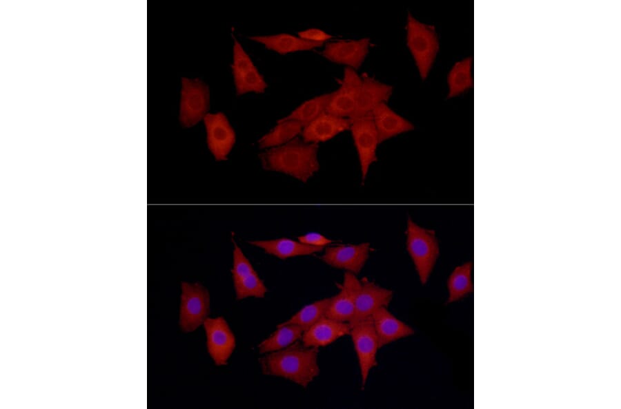 Immunofluorescence - Anti-SQSTM1 / p62 Antibody (A309479) - Antibodies.com