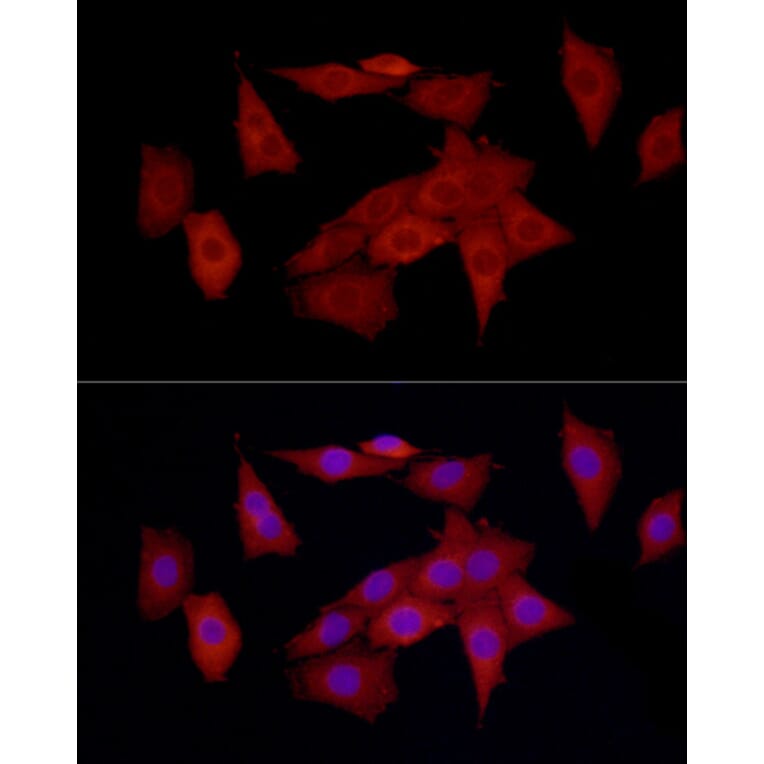 Immunofluorescence - Anti-SQSTM1 / p62 Antibody (A309479) - Antibodies.com