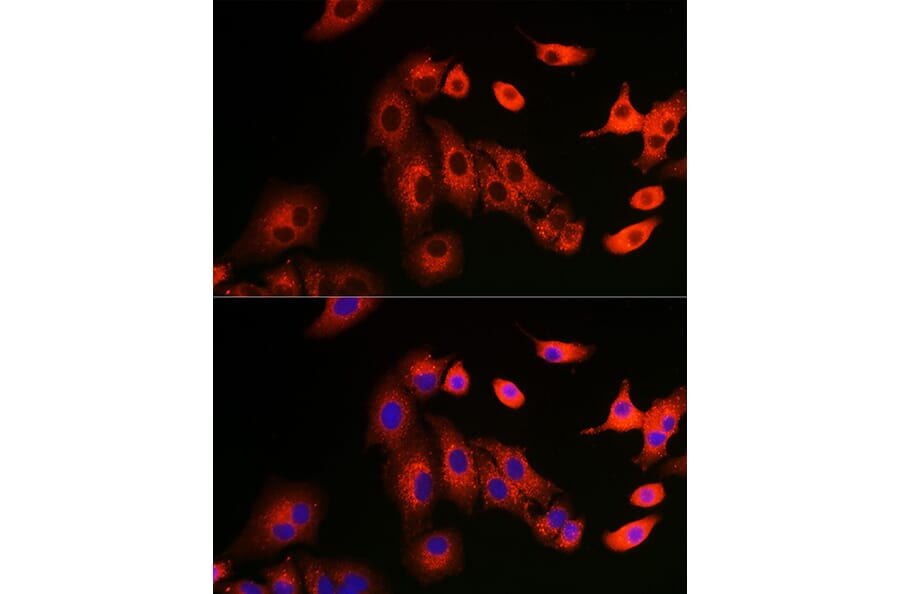 Immunofluorescence - Anti-SQSTM1 / p62 Antibody (A309479) - Antibodies.com