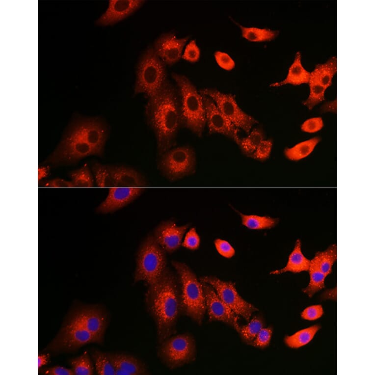 Immunofluorescence - Anti-SQSTM1 / p62 Antibody (A309479) - Antibodies.com