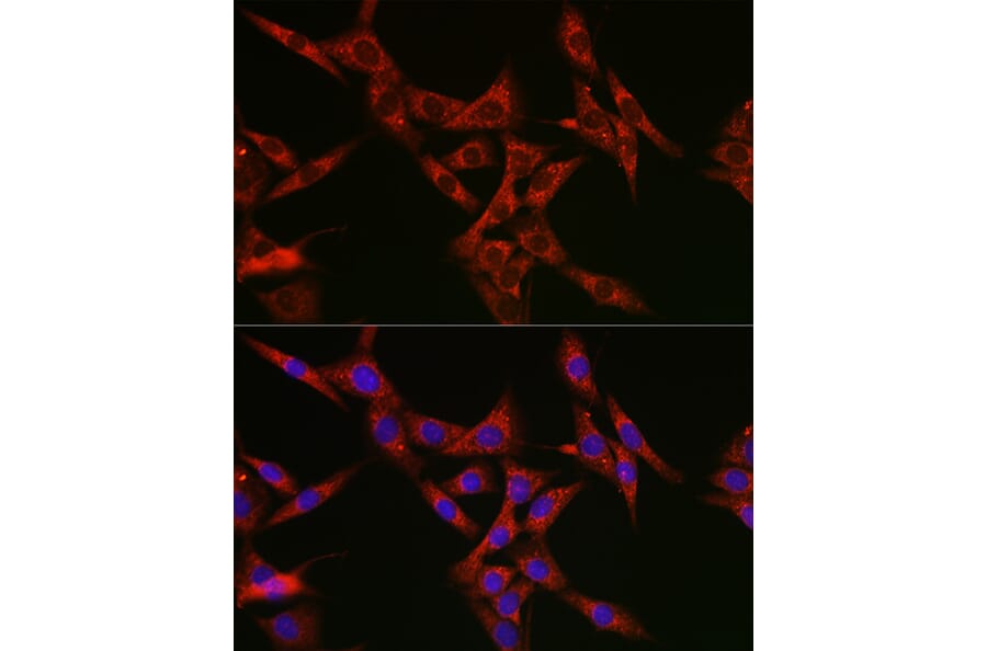 Immunofluorescence - Anti-SQSTM1 / p62 Antibody (A309479) - Antibodies.com