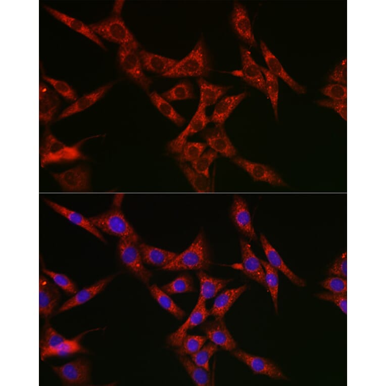 Immunofluorescence - Anti-SQSTM1 / p62 Antibody (A309479) - Antibodies.com