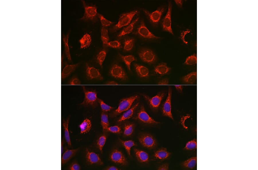 Immunofluorescence - Anti-SQSTM1 / p62 Antibody (A309479) - Antibodies.com