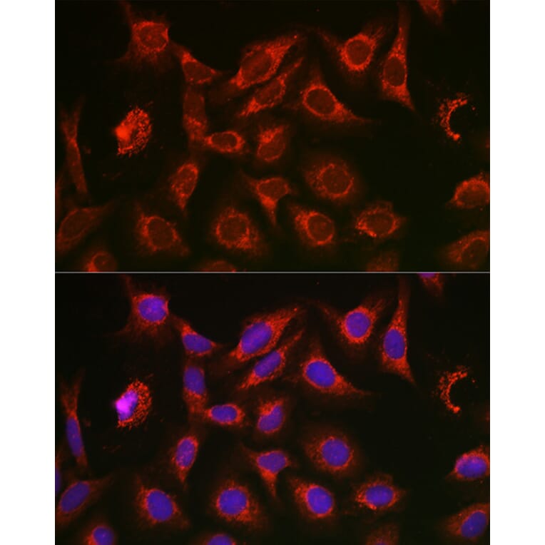 Immunofluorescence - Anti-SQSTM1 / p62 Antibody (A309479) - Antibodies.com