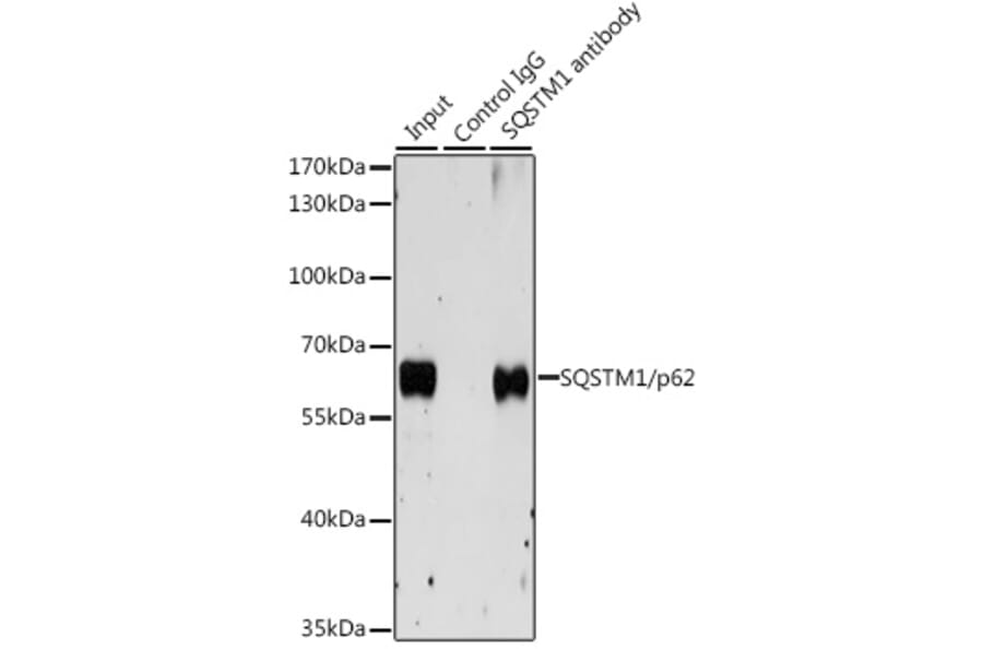 Western Blot - Anti-SQSTM1 / p62 Antibody (A309479) - Antibodies.com
