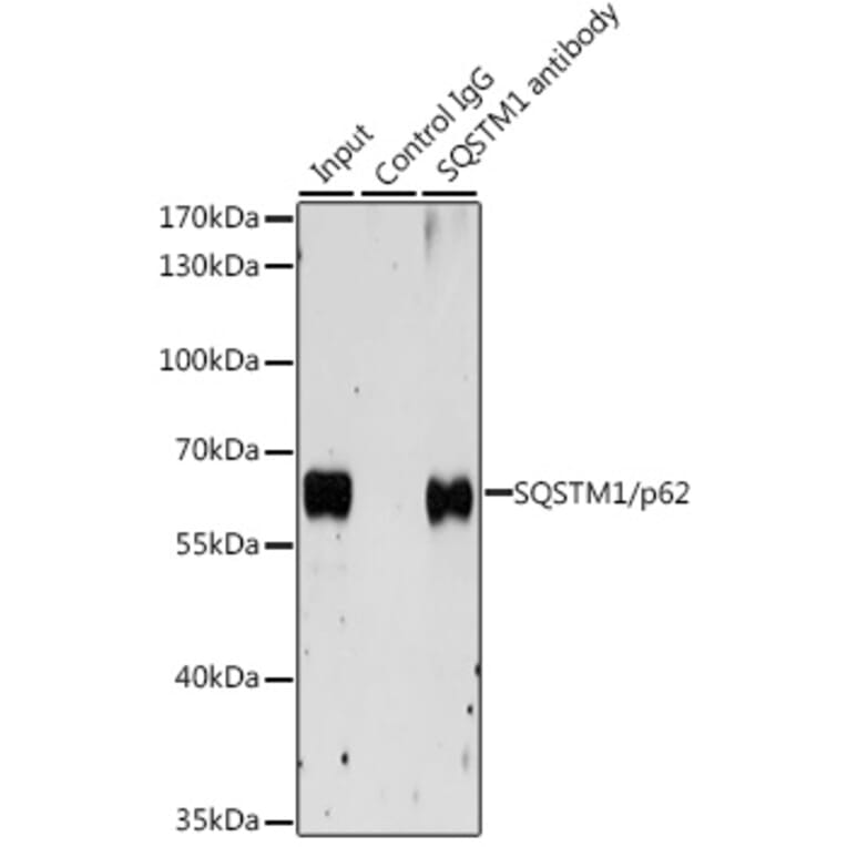 Western Blot - Anti-SQSTM1 / p62 Antibody (A309479) - Antibodies.com