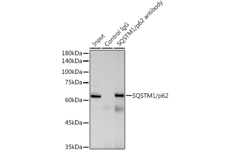 Western Blot - Anti-SQSTM1 / p62 Antibody (A309479) - Antibodies.com