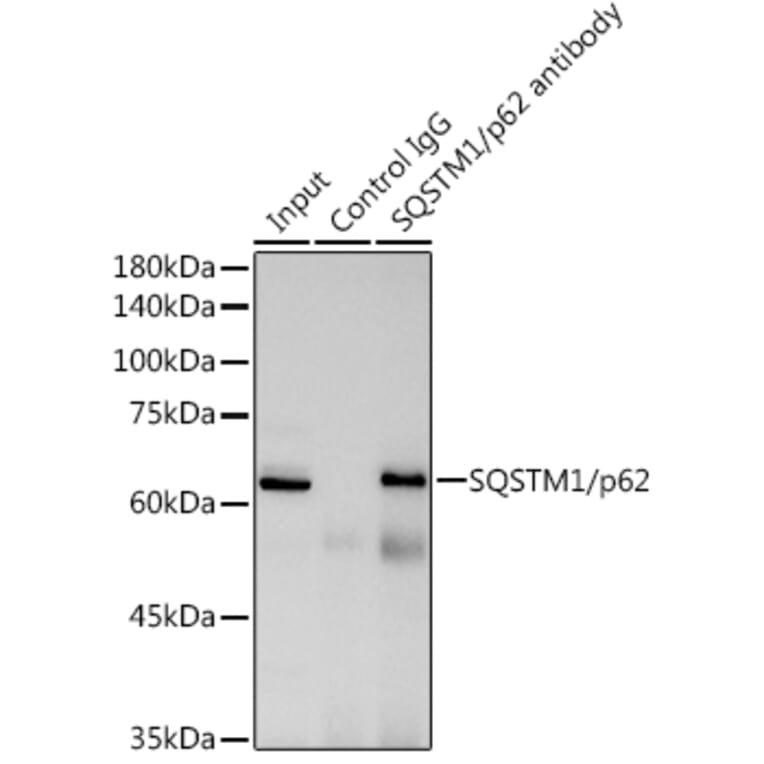 Western Blot - Anti-SQSTM1 / p62 Antibody (A309479) - Antibodies.com