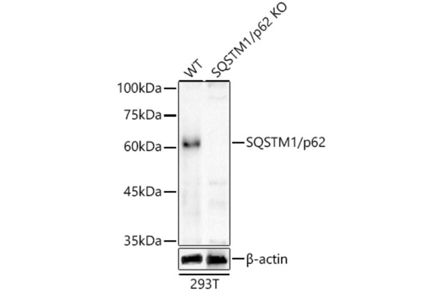 Western Blot - Anti-SQSTM1 / p62 Antibody (A309479) - Antibodies.com