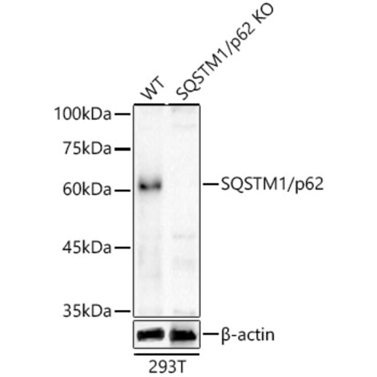 Western Blot - Anti-SQSTM1 / p62 Antibody (A309479) - Antibodies.com