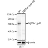 Western Blot - Anti-SQSTM1 / p62 Antibody (A309479) - Antibodies.com