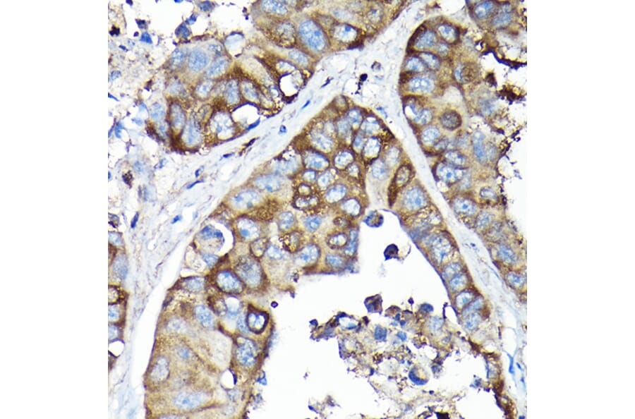 Immunohistochemistry - Anti-SQSTM1 / p62 Antibody (A309479) - Antibodies.com