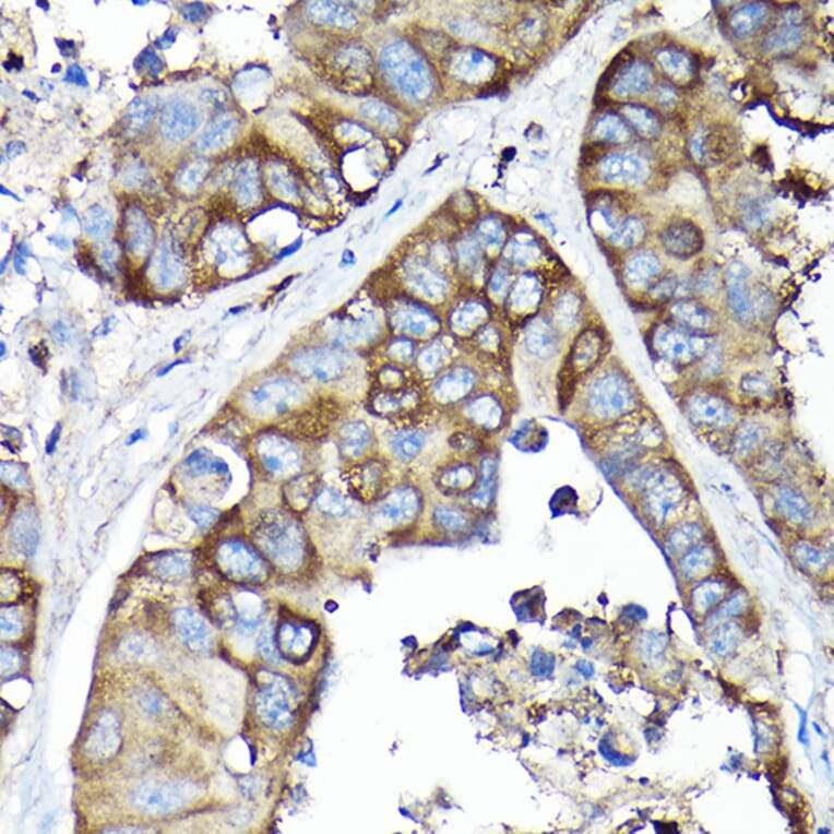 Immunohistochemistry - Anti-SQSTM1 / p62 Antibody (A309479) - Antibodies.com