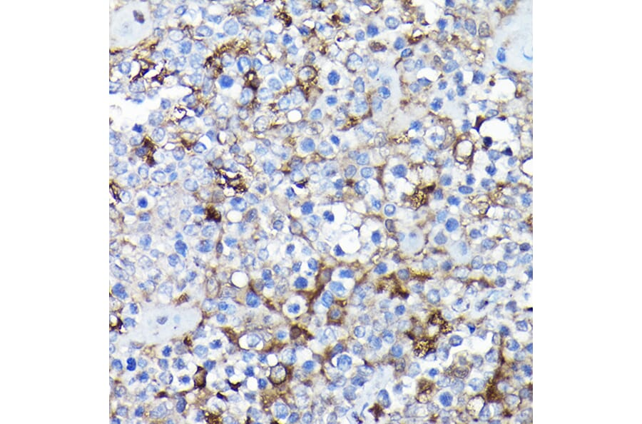 Immunohistochemistry - Anti-SQSTM1 / p62 Antibody (A309479) - Antibodies.com