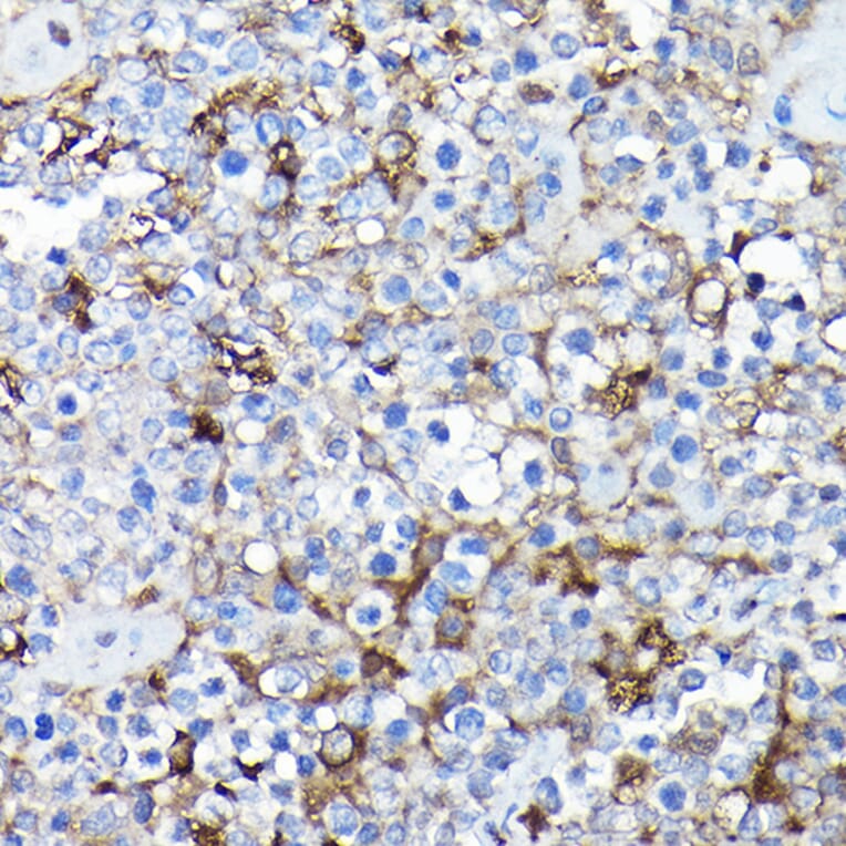 Immunohistochemistry - Anti-SQSTM1 / p62 Antibody (A309479) - Antibodies.com