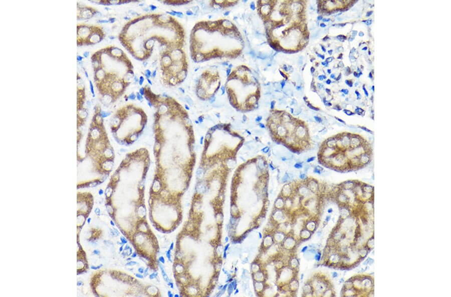 Immunohistochemistry - Anti-SQSTM1 / p62 Antibody (A309479) - Antibodies.com