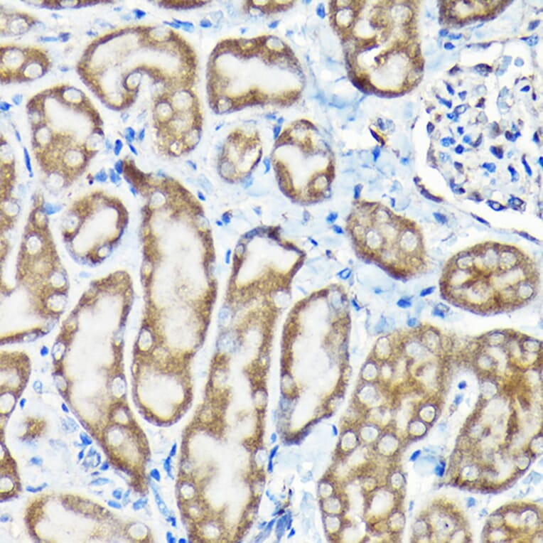 Immunohistochemistry - Anti-SQSTM1 / p62 Antibody (A309479) - Antibodies.com