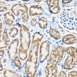 Immunohistochemistry - Anti-SQSTM1 / p62 Antibody (A309479) - Antibodies.com