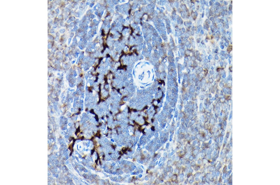 Immunohistochemistry - Anti-SQSTM1 / p62 Antibody (A309479) - Antibodies.com