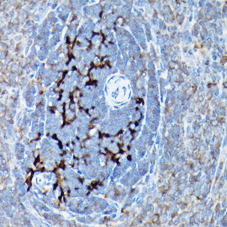 Immunohistochemistry - Anti-SQSTM1 / p62 Antibody (A309479) - Antibodies.com