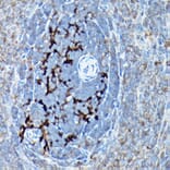 Immunohistochemistry - Anti-SQSTM1 / p62 Antibody (A309479) - Antibodies.com