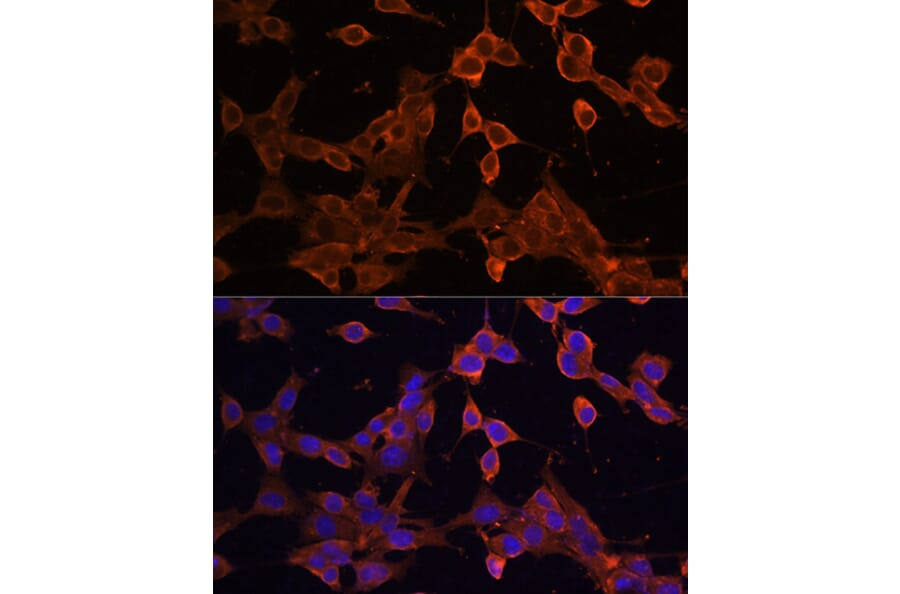 Immunofluorescence - Anti-SQSTM1 / p62 Antibody (A309479) - Antibodies.com