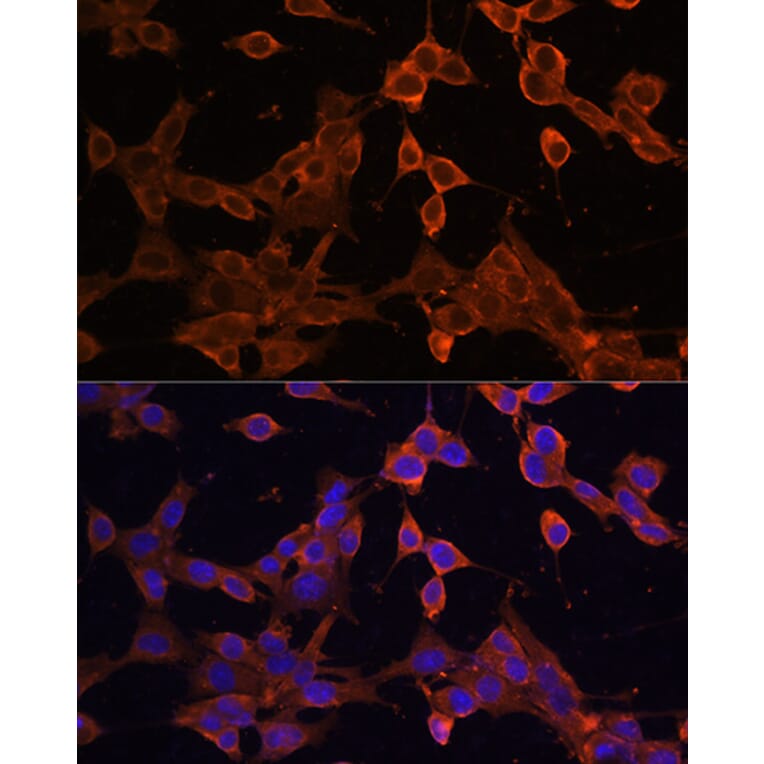 Immunofluorescence - Anti-SQSTM1 / p62 Antibody (A309479) - Antibodies.com