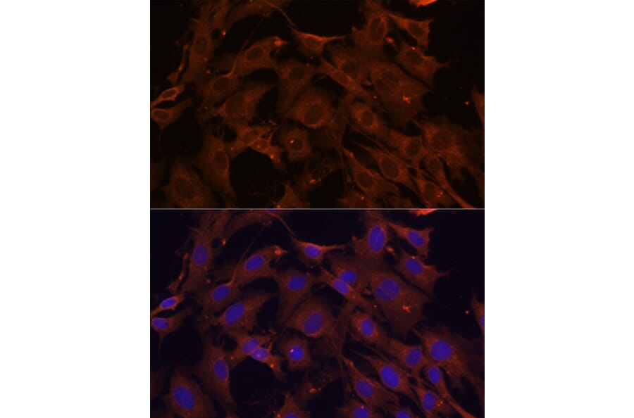 Immunofluorescence - Anti-SQSTM1 / p62 Antibody (A309479) - Antibodies.com