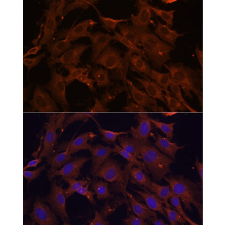 Immunofluorescence - Anti-SQSTM1 / p62 Antibody (A309479) - Antibodies.com