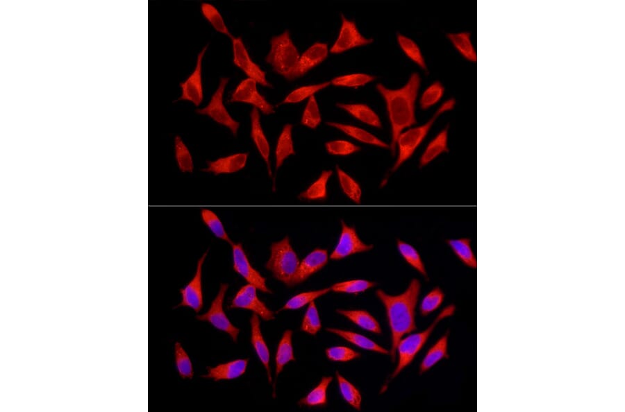 Immunofluorescence - Anti-SQSTM1 / p62 Antibody (A309479) - Antibodies.com